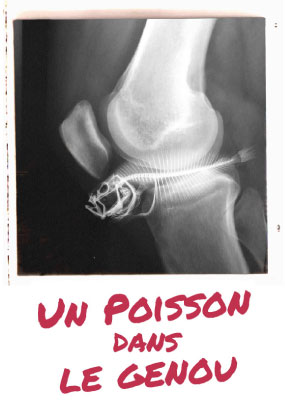 Un poisson dans le genou